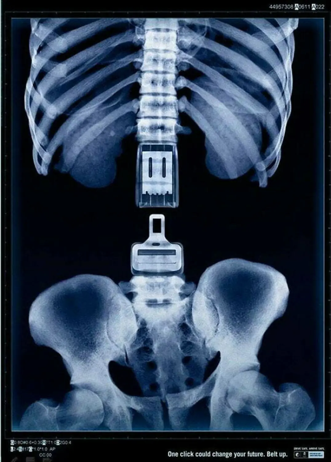 Buckle Up ad with an X-ray of a spine integrated with a seatbelt, highlighting seatbelt safety